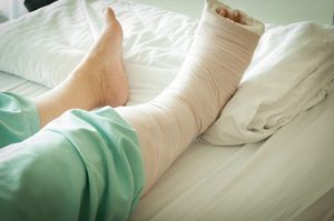 achilles tendon rupture recovery