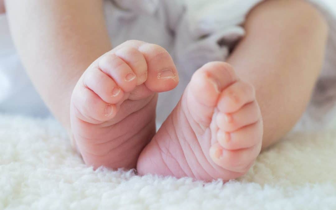 How Infant Intoeing Is Treated