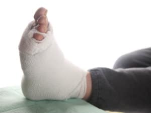 Foot and Ankle Surgery: What to Expect