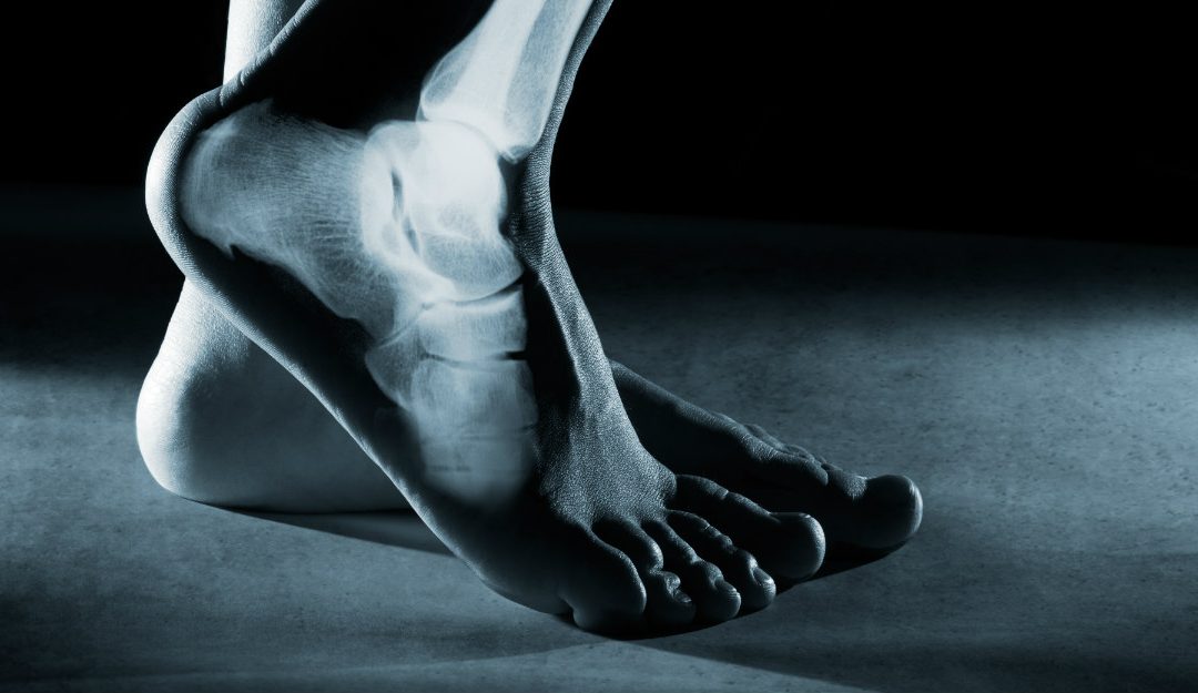 Do You Need Foot Surgery?