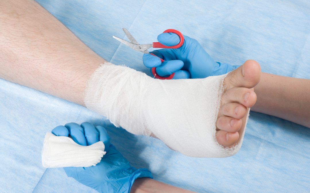 What You Need to Know About Foot & Ankle Reconstruction