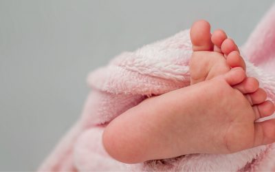 Clubfoot: What Every Parent Needs to Know