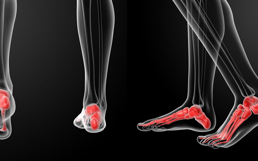 How Your Foot Structure May Be Making You Fall Apart