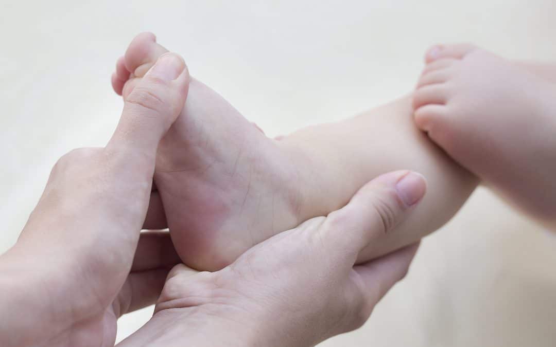 What Is Clubfoot Treatment Like for My Child at Each Stage?