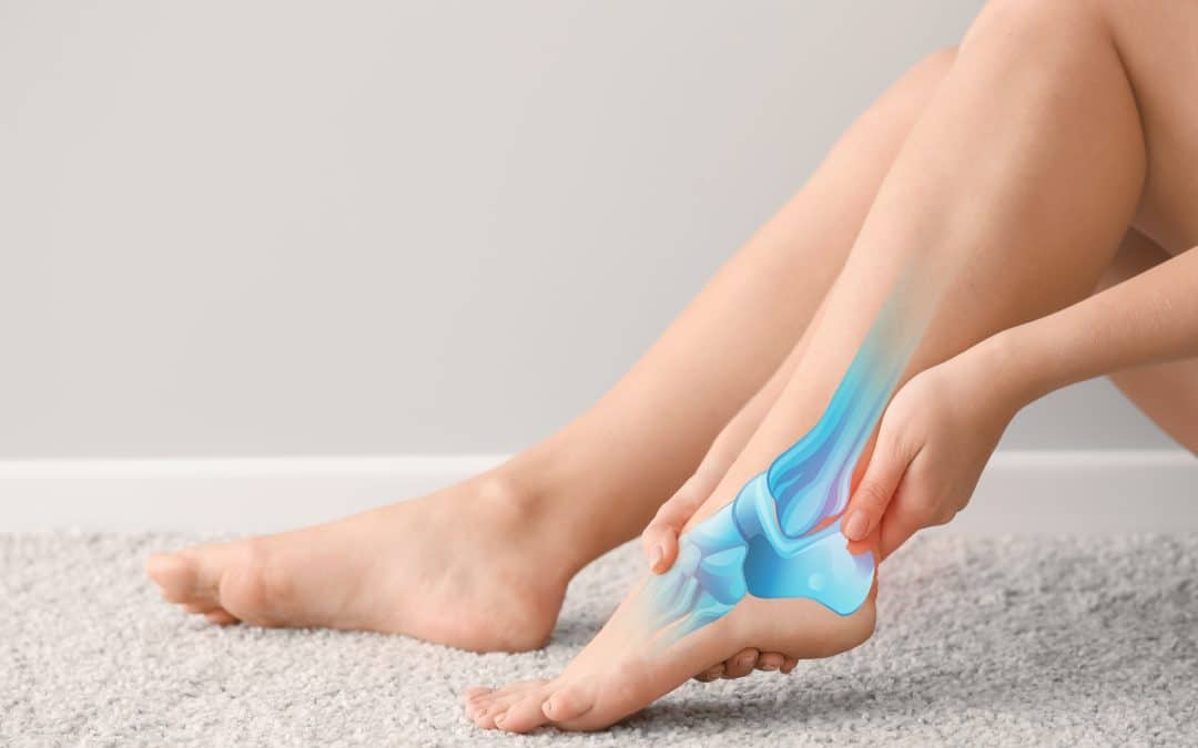 Living with Arthritis of the Foot or Ankle