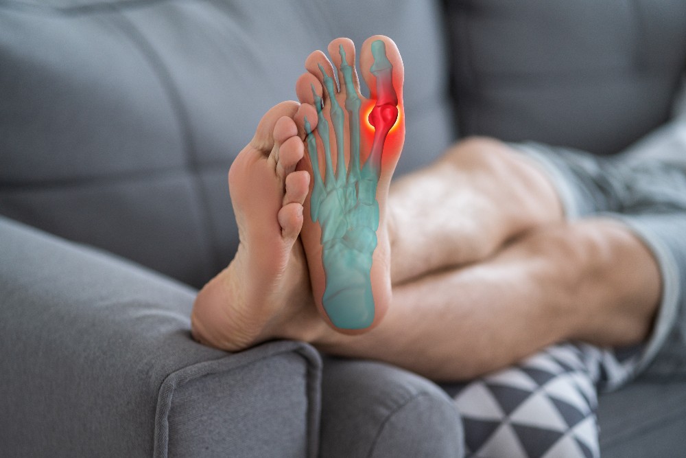 Man laying on couch showing an X-ray of where a bunion forms