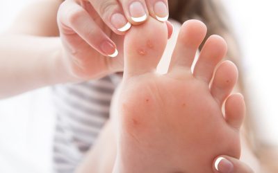Don’t Let Plantar Warts Haunt Your Feet!