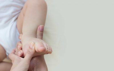 4 Myths About Clubfoot