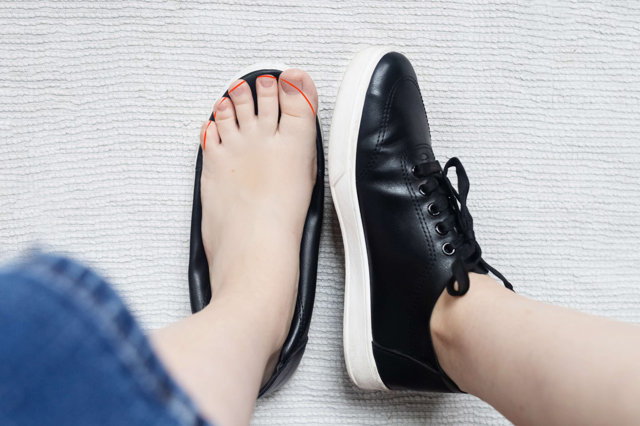 How to Avoid Ingrown Toenails Southern California Foot & Ankle