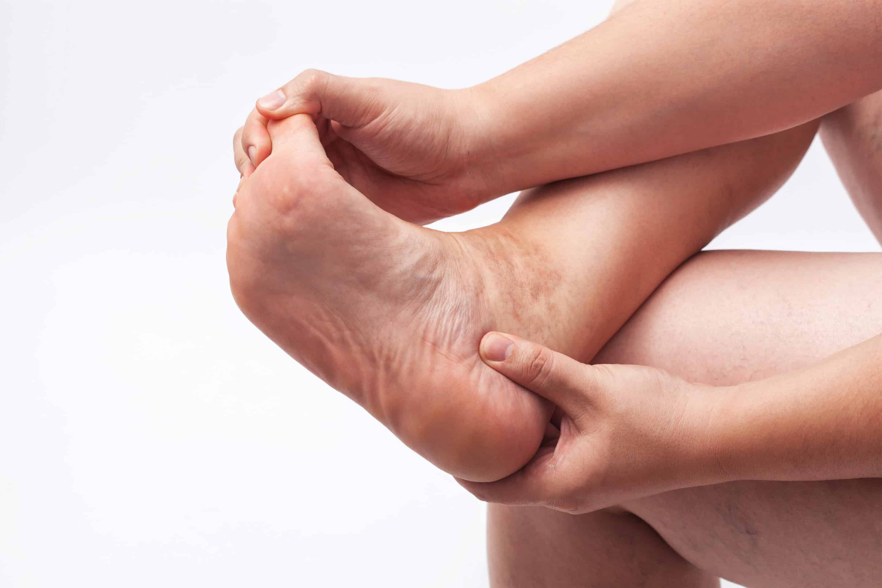 person touching feet with painful heel due to plantar fasciitis person touching feet with painful heel due to plantar fasciitis