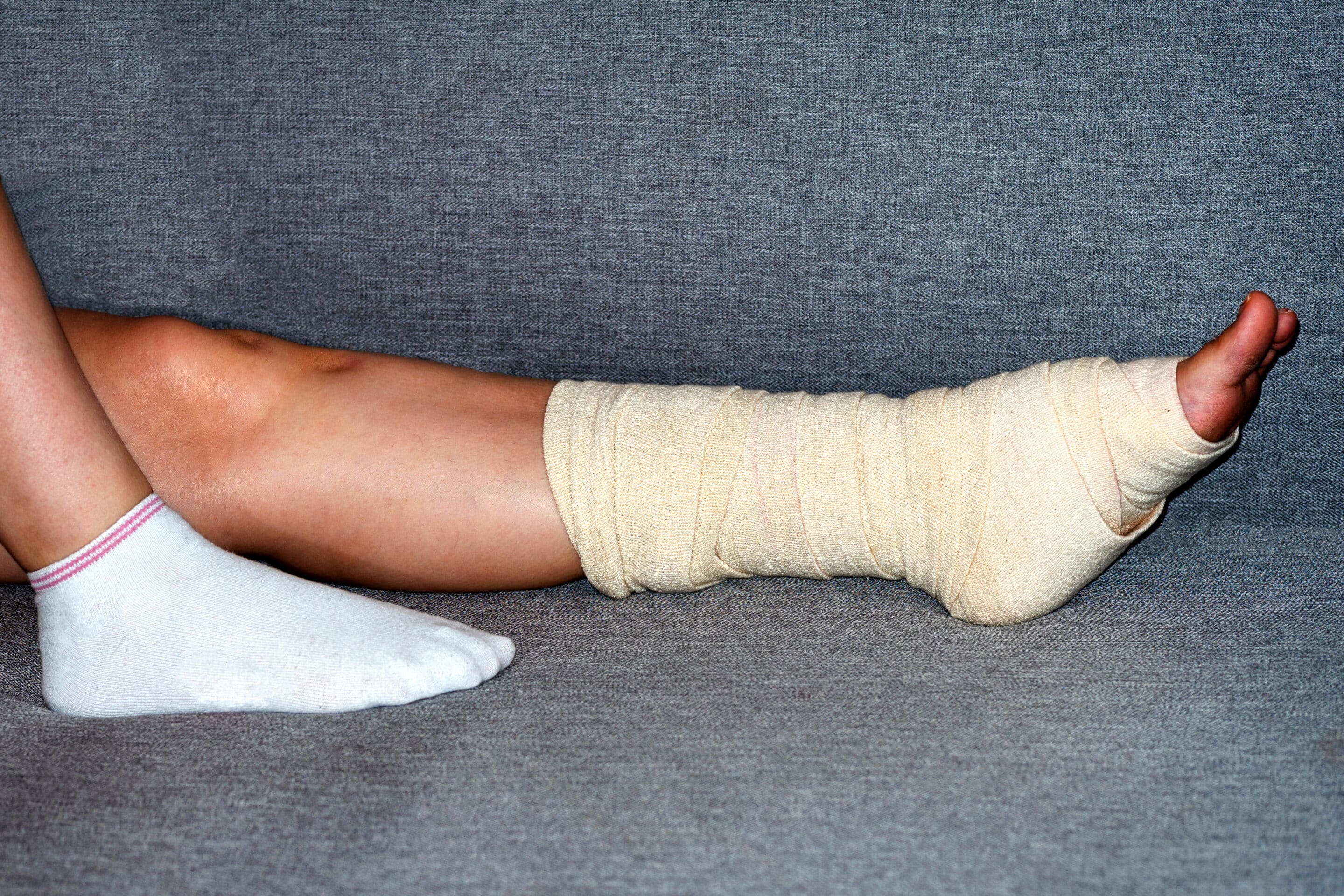 broken leg.bandaging foot broken leg.bandaging foot